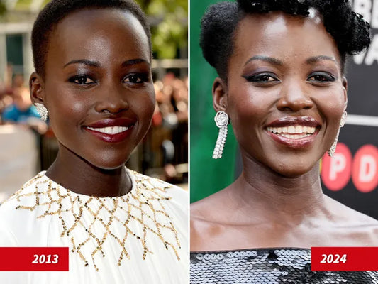 TMZ Downplays Lupita Nyong'o's Beauty